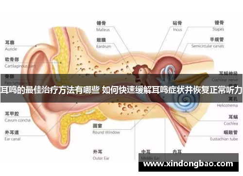 耳鸣的最佳治疗方法有哪些 如何快速缓解耳鸣症状并恢复正常听力